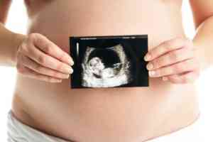 сколько раз можно делать УЗИ при беременности - Список новостей ...